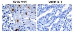 SARS-CoV-2 NSP10 Antibody - BSA Free, Novus Biologicals 0.1 mg | Buy Online | Novus Biologicals | Fisher Scientific