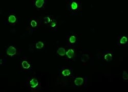 SARS-CoV-2 Nucleocapsid Antibody (004), Novus Biologicals 100 &mu;g; Unconjugated:Antibodies,