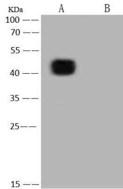 SARS-CoV-2 Nucleocapsid Antibody (019), Novus Biologicals 100 &mu;g; Unconjugated:Anticorps,