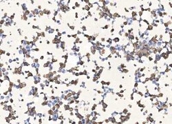 SARS-CoV-2 Nucleocapsid Antibody (040), Novus Biologicals:Antibodies:Primary