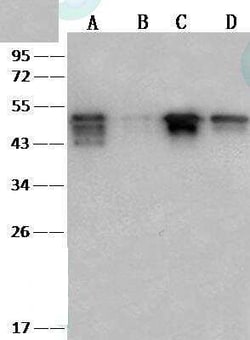 SARS-CoV-2 Nucleocapsid Antibody (040), Novus Biologicals:Antibodies:Primary