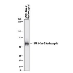 SARS-CoV-2 Nucleocapsid Antibody - BSA Free, Novus Biologicals 0.025 mg;