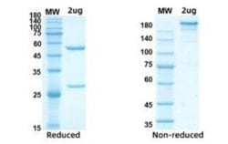 SARS-CoV-2 Nucleocapsid Antibody (D207) - Azide and BSA Free, Novus Biologicals