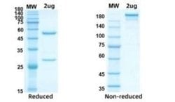 SARS-CoV-2 Nucleocapsid Antibody (G733) - Azide and BSA Free, Novus Biologicals