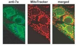 SARS-CoV-2 ORF7a Antibody (3C9), Novus Biologicals 100 &mu;g; Unconjugated:Antibodies,