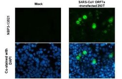SARS-CoV-2 ORF7a Antibody (3C9), Novus Biologicals 100 &mu;g; Unconjugated:Antibodies,