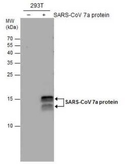 SARS-CoV-2 ORF7a Antibody (3C9), Novus Biologicals 100 &mu;g; Unconjugated:Antibodies,