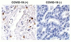 SARS-CoV-2 ORF7a Antibody - BSA Free, Novus Biologicals 0.1 mg | Buy Online | Novus Biologicals | Fisher Scientific