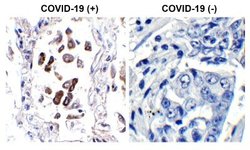 SARS-CoV-2 ORF8 Antibody - BSA Free, Novus Biologicals 0.1 mg; Unconjugated:Antibodies,