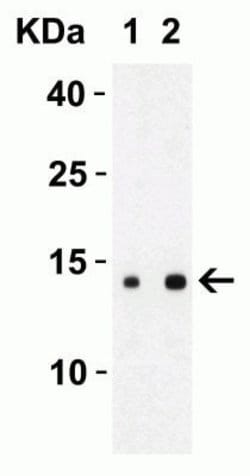 SARS-CoV-2 ORF8 Antibody - BSA Free, Novus Biologicals 0.1 mg; Unconjugated:Antibodies,