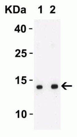SARS-CoV-2 ORF8 Antibody - BSA Free, Novus Biologicals 0.1 mg | Buy Online | Novus Biologicals | Fisher Scientific