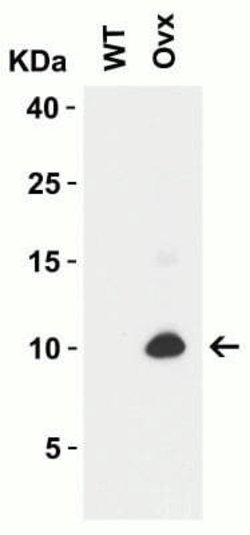 SARS-CoV-2 ORF9c Antibody - BSA Free, Novus Biologicals 0.1 mg | Buy Online | Bio-Techne | Fisher Scientific