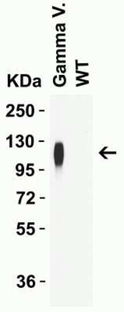 SARS-CoV-2 Spike Antibody (5G12G11) - Gamma Variant, P.1, Brazil - BSA Free, Novus Biologicals 0.1 mg | Buy Online | Novus Biologicals | Fisher Scientific