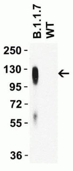 SARS-CoV-2 Spike Antibody (7C11H11) - Alpha Variant, B.1.1.7, UK - BSA Free, Novus Biologicals 0.1 mg | Buy Online | Novus Biologicals | Fisher Scientific