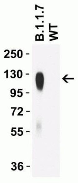 SARS-CoV-2 Spike Antibody (9F7E4) - Alpha Variant, B.1.1.7, UK - BSA Free, Novus Biologicals 0.1 mg | Buy Online | Novus Biologicals | Fisher Scientific