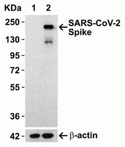SARS-CoV-2 Spike Antibody - BSA Free, Novus Biologicals 0.1 mg | Buy Online | Novus Biologicals | Fisher Scientific