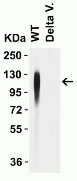 SARS-CoV-2 Spike Antibody - BSA Free, Novus Biologicals 0.1 mg | Buy Online | Novus Biologicals | Fisher Scientific