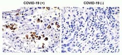 SARS-CoV-2 Spike S2 Antibody - BSA Free, Novus Biologicals 50 &mu;g; Unconjugated:Antibodies