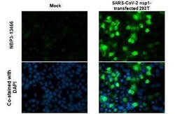 SARS-CoV-2 nsp1 Antibody, Novus Biologicals 100 &mu;g | Buy Online | Novus Biologicals | Fisher Scientific