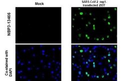 SARS-CoV-2 nsp1 Antibody, Novus Biologicals 100 &mu;g | Buy Online | Novus Biologicals | Fisher Scientific