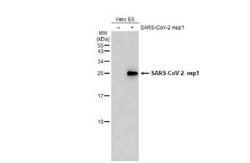SARS-CoV-2 nsp1 Antibody, Novus Biologicals 100 &mu;g | Buy Online | Novus Biologicals | Fisher Scientific