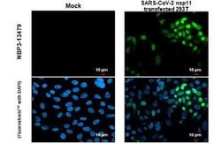 SARS-CoV-2 nsp11 Antibody, Novus Biologicals 100 &mu;g | Buy Online | Novus Biologicals | Fisher Scientific