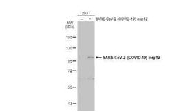 SARS-CoV-2 nsp12 Antibody, Novus Biologicals 100 &mu;g; Unconjugated:Antibodies