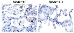SARS-CoV-2 nsp13 Antibody - BSA Free, Novus Biologicals 0.1 mg | Buy Online | Novus Biologicals | Fisher Scientific