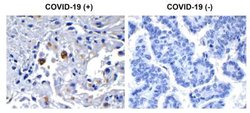SARS-CoV-2 nsp13 Antibody - BSA Free, Novus Biologicals 0.1 mg | Buy Online | Novus Biologicals | Fisher Scientific
