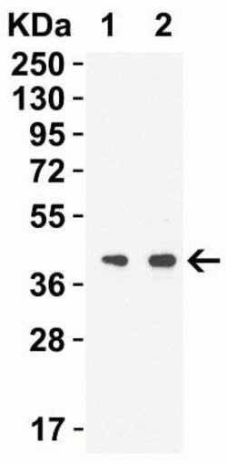 SARS-CoV-2 nsp15 Antibody - BSA Free, Novus Biologicals 0.1 mg | Buy Online | Novus Biologicals | Fisher Scientific