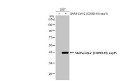 SARS-CoV-2 nsp15 Antibody, Novus Biologicals 100 &mu;g | Buy Online | Novus Biologicals | Fisher Scientific
