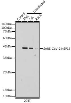 SARS-CoV-2 nsp15 Rabbit anti-SARS-CoV-2, Polyclonal, Novus Biologicals 100 &mu;g | Buy Online | Novus Biologicals | Fisher Scientific
