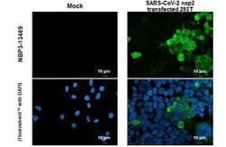 SARS-CoV-2 nsp2 Antibody, Novus Biologicals 100 &mu;g | Buy Online | Novus Biologicals | Fisher Scientific