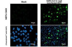 SARS-CoV-2 nsp2 Antibody, Novus Biologicals 100 &mu;g | Buy Online | Novus Biologicals | Fisher Scientific