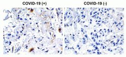 SARS-CoV-2 nsp2 Antibody - BSA Free, Novus Biologicals 0.1 mg | Buy Online | Novus Biologicals | Fisher Scientific