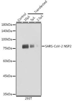 SARS-CoV-2 nsp2 Rabbit anti-SARS-CoV-2, Polyclonal, Novus Biologicals 100 &mu;g | Buy Online | Novus Biologicals | Fisher Scientific