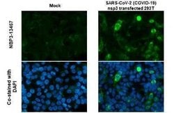 SARS-CoV-2 nsp3 Antibody, Novus Biologicals 100 &mu;g | Buy Online | Novus Biologicals | Fisher Scientific