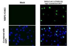SARS-CoV-2 nsp3 Antibody, Novus Biologicals 100 &mu;g | Buy Online | Novus Biologicals | Fisher Scientific