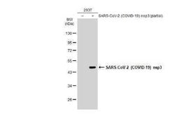 SARS-CoV-2 nsp3 Antibody, Novus Biologicals 100 &mu;g | Buy Online | Novus Biologicals | Fisher Scientific