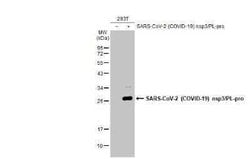 SARS-CoV-2 nsp3 Antibody, Novus Biologicals 100 &mu;g; Unconjugated:Antibodies,