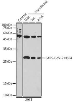 SARS-CoV-2 nsp4 Rabbit anti-SARS-CoV-2, Polyclonal, Novus Biologicals 20 &mu;g | Buy Online | Novus Biologicals | Fisher Scientific