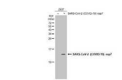 SARS-CoV-2 nsp7 Antibody, Novus Biologicals 100 &mu;g | Buy Online | Novus Biologicals | Fisher Scientific