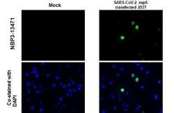 SARS-CoV-2 nsp8 Antibody, Novus Biologicals 100 &mu;g | Buy Online | Novus Biologicals | Fisher Scientific