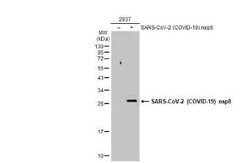 SARS-CoV-2 nsp8 Antibody, Novus Biologicals 100 &mu;g | Buy Online | Novus Biologicals | Fisher Scientific