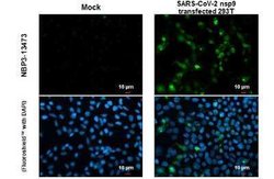 SARS-CoV-2 nsp9 Antibody, Novus Biologicals 100 &mu;g; Unconjugated:Antibodies,