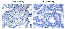 SARS-CoV-2 nsp9 Antibody - BSA Free, Novus Biologicals 0.1 mg | Buy Online | Novus Biologicals | Fisher Scientific