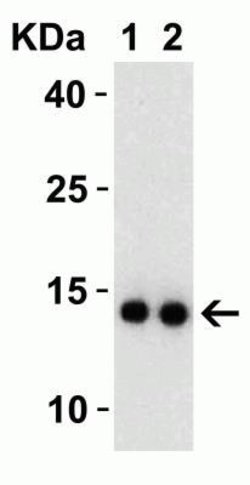 SARS-CoV-2 nsp9 Antibody - BSA Free, Novus Biologicals 0.1 mg | Buy Online | Novus Biologicals | Fisher Scientific