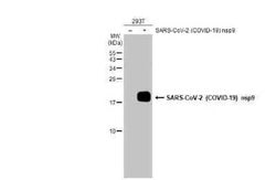 SARS-CoV-2 nsp9 Antibody, Novus Biologicals 100 &mu;g; Unconjugated:Antibodies,