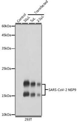 SARS-CoV-2 nsp9 Rabbit anti-SARS-CoV-2, Polyclonal, Novus Biologicals 100 &mu;g | Buy Online | Novus Biologicals | Fisher Scientific