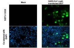 SARS-CoV NSP8 Antibody (5A10), Novus Biologicals 100 &mu;g; Unconjugated:Antibodies,